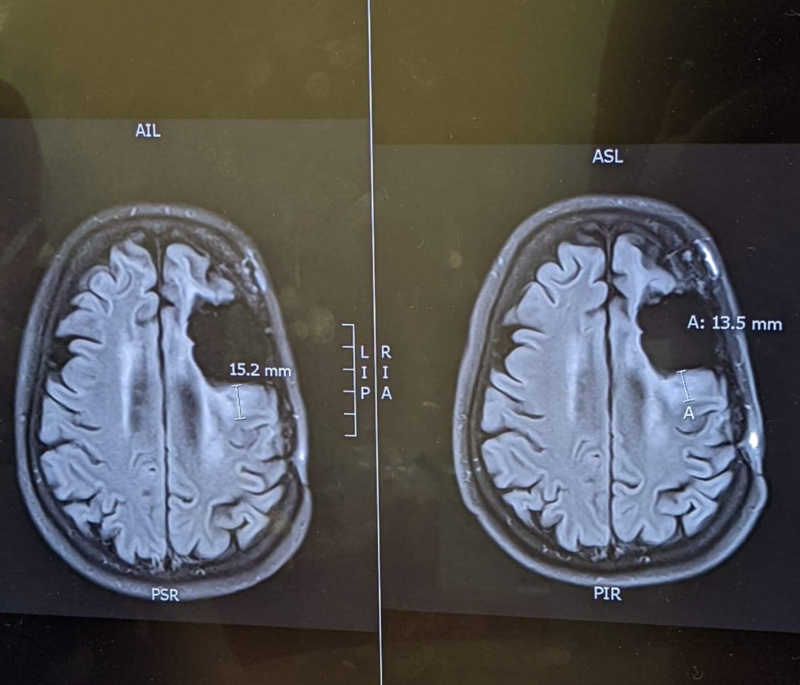 Cerveau avril 2022