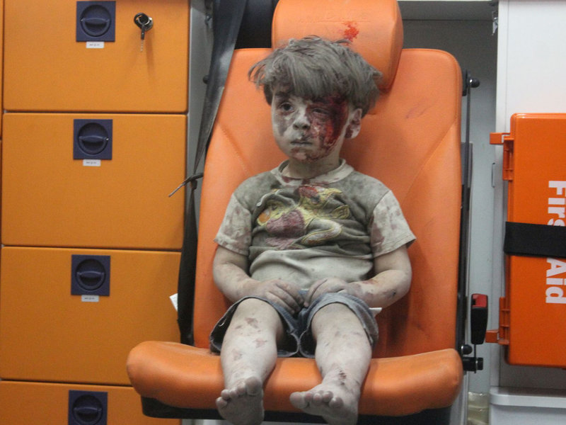 omrane-un-jeune-syrien-de-4-ans-blesse-dans-un-bombardement-a-alep-le-17-aout-2016_5655643