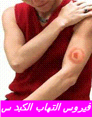 images_VHC
